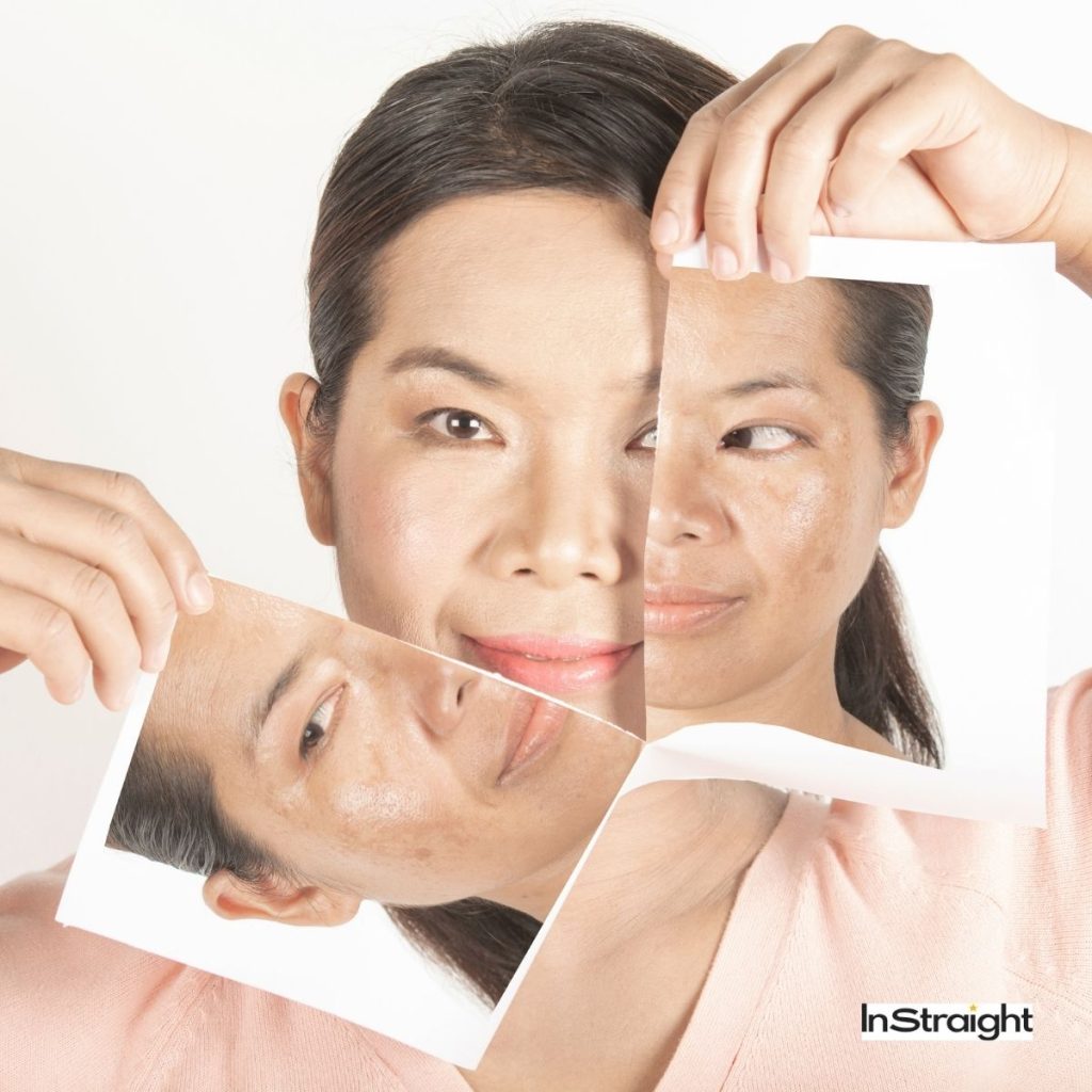 a woman showing how to hide dark spots on your face without makeup